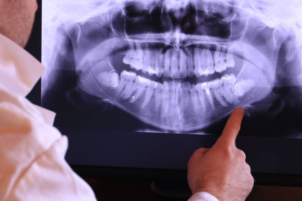 Best Emergency Treatment for Dental Infections or Abscesses in Waltham, MA